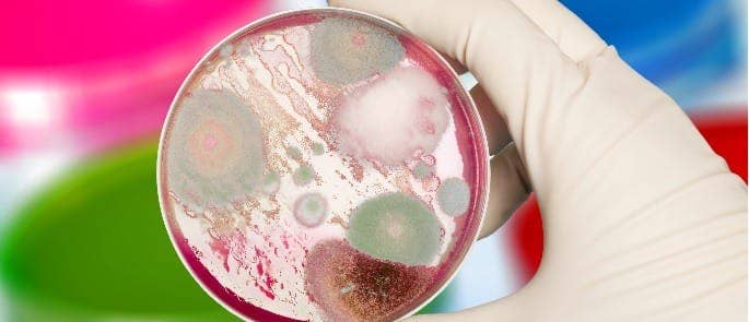Inspección de bacterias alimentarias